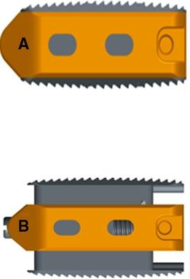 Comparison of the efficacy of expandable interbody fusion cage (EXP-IFC) and non-expandable interbody fusion cage (NE-IFC) in MIS-TLIF for lumbar degenerative diseases: A systematic retrospective study on 62 patients